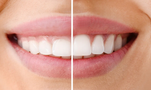 Dental Clinic in Perungudi,Dental Clinic in Taramani
